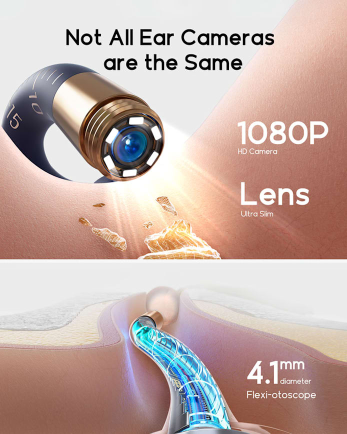 Smart Ear Kit – Safe & Effective